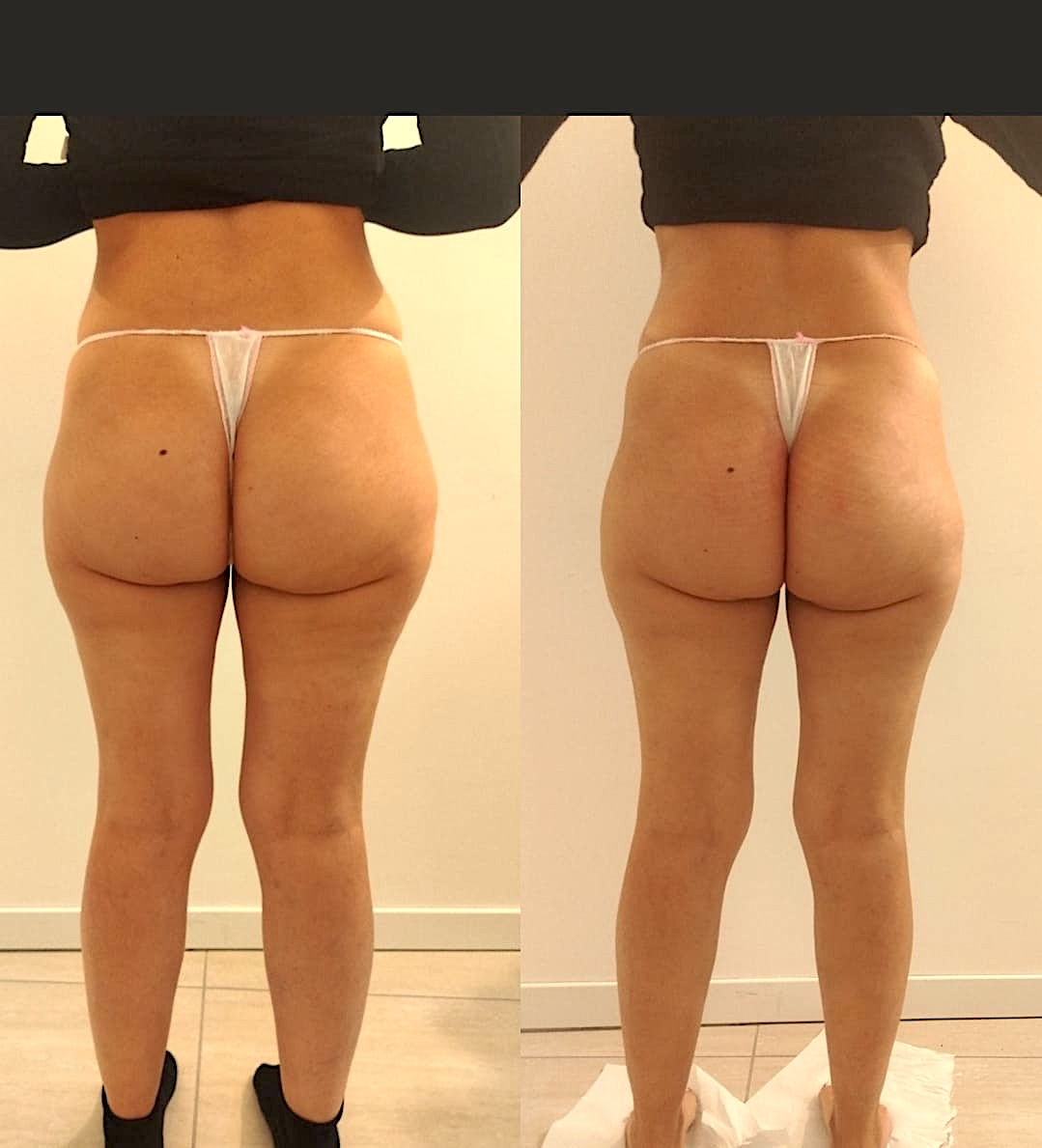 Dettaglio di gambe rilassate durante un massaggio drenante