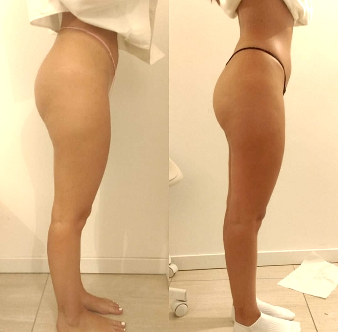 Dettaglio di gambe rilassate durante un massaggio drenante