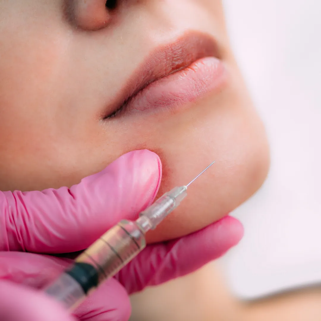 Dermal Filler in