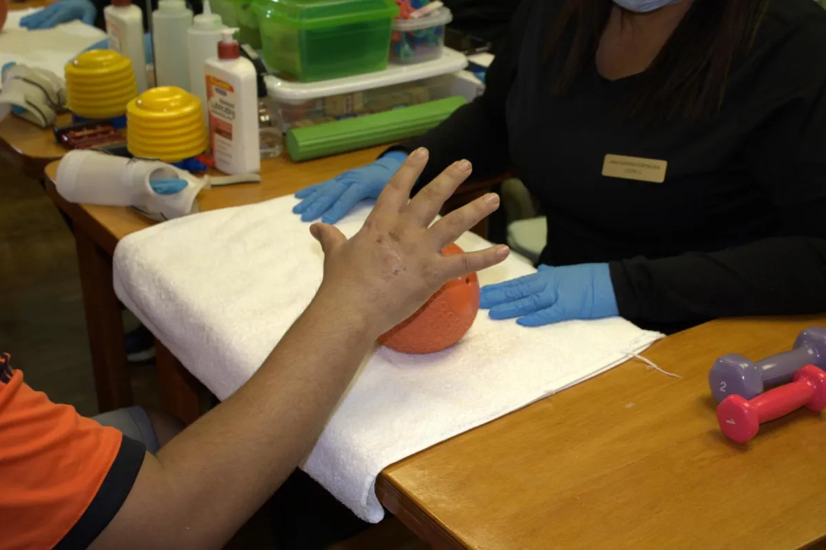 occupational therapy and hand rehabilitation