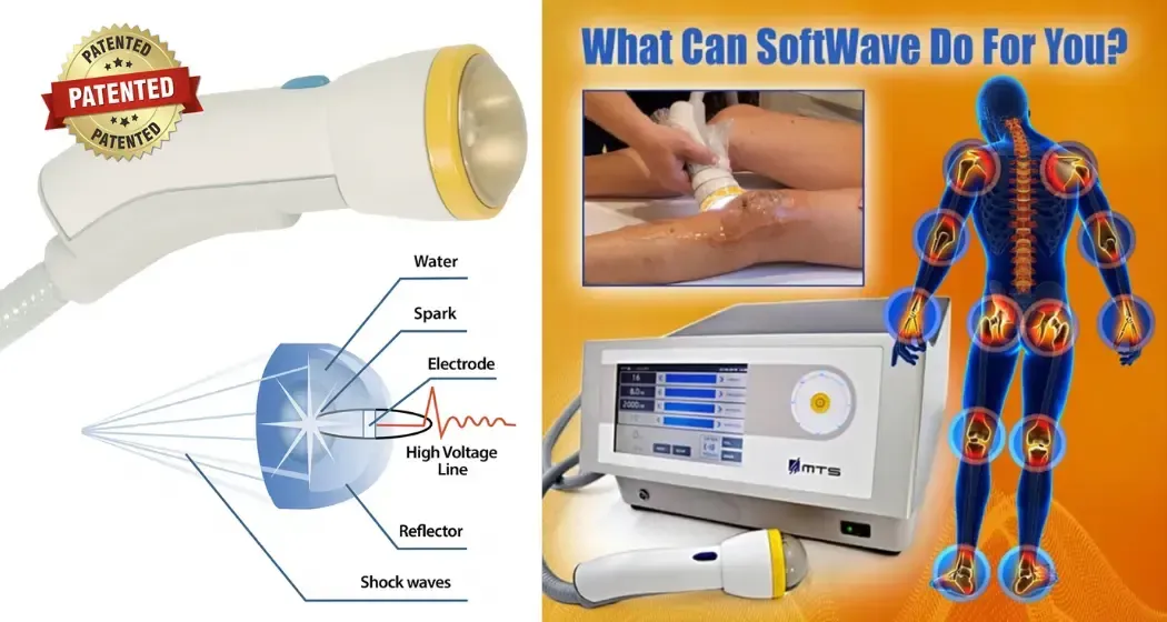 Softwave Therapy for Neuropathy