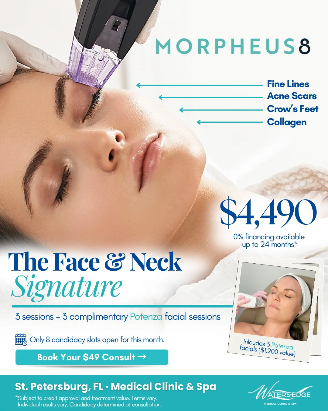 Softwave Therapy Waters Edge Medical Clinic