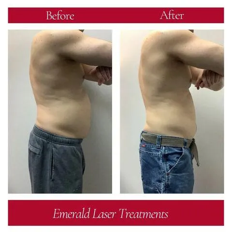 Lymphatic drainage in Edmond, OK with gentle tools