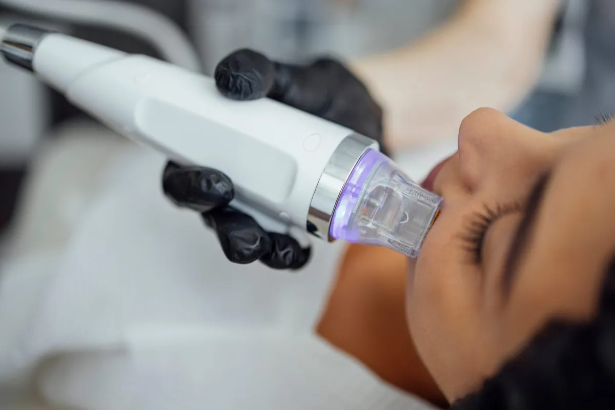 RF Fractional Mcro-Needling