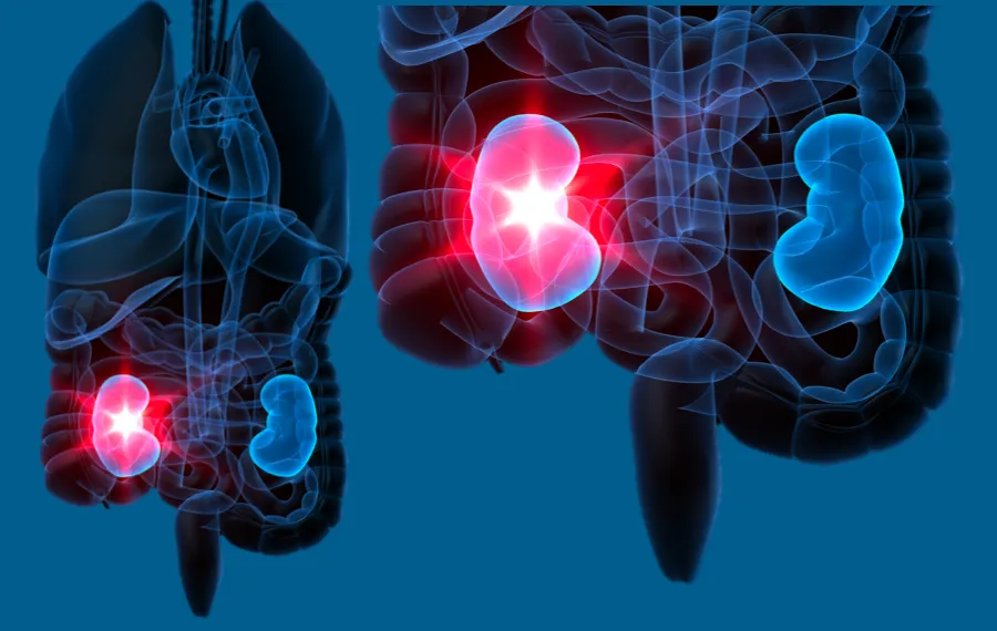Adrenal Glands
