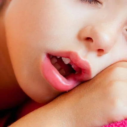 Mouth Breathing & Open-Mouth Posture