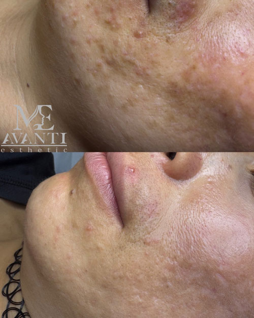 Balayage hair transformation Bayonne NJ