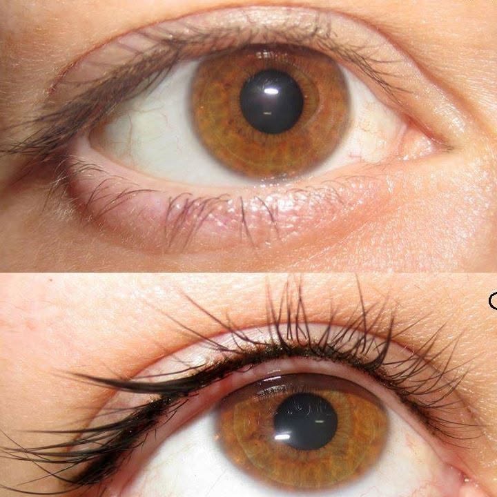 A woman with brown eyes shows her eyebrows before and after a microblading procedure, highlighting the transformation.