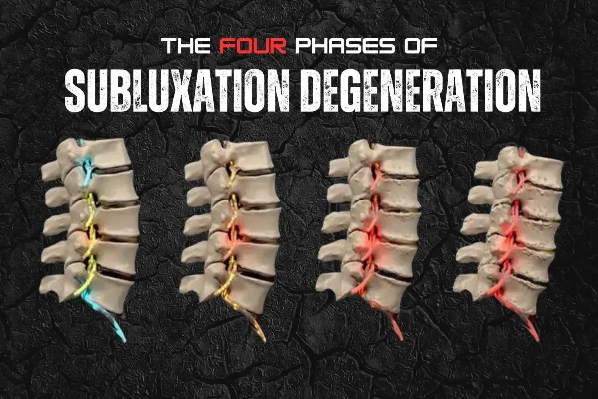 Subluxation diagram