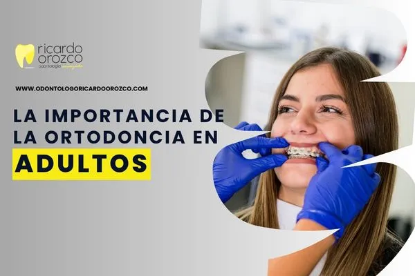 Desde el punto de vista clínico, los dientes pueden moverse a lo largo de toda la vida. Lo que cambia con la edad no es la capacidad de movimiento, sino el ritmo — en adultos el proceso puede ser ligeramente más lento que en adolescentes, pero los resultados son igualmente efectivos.
