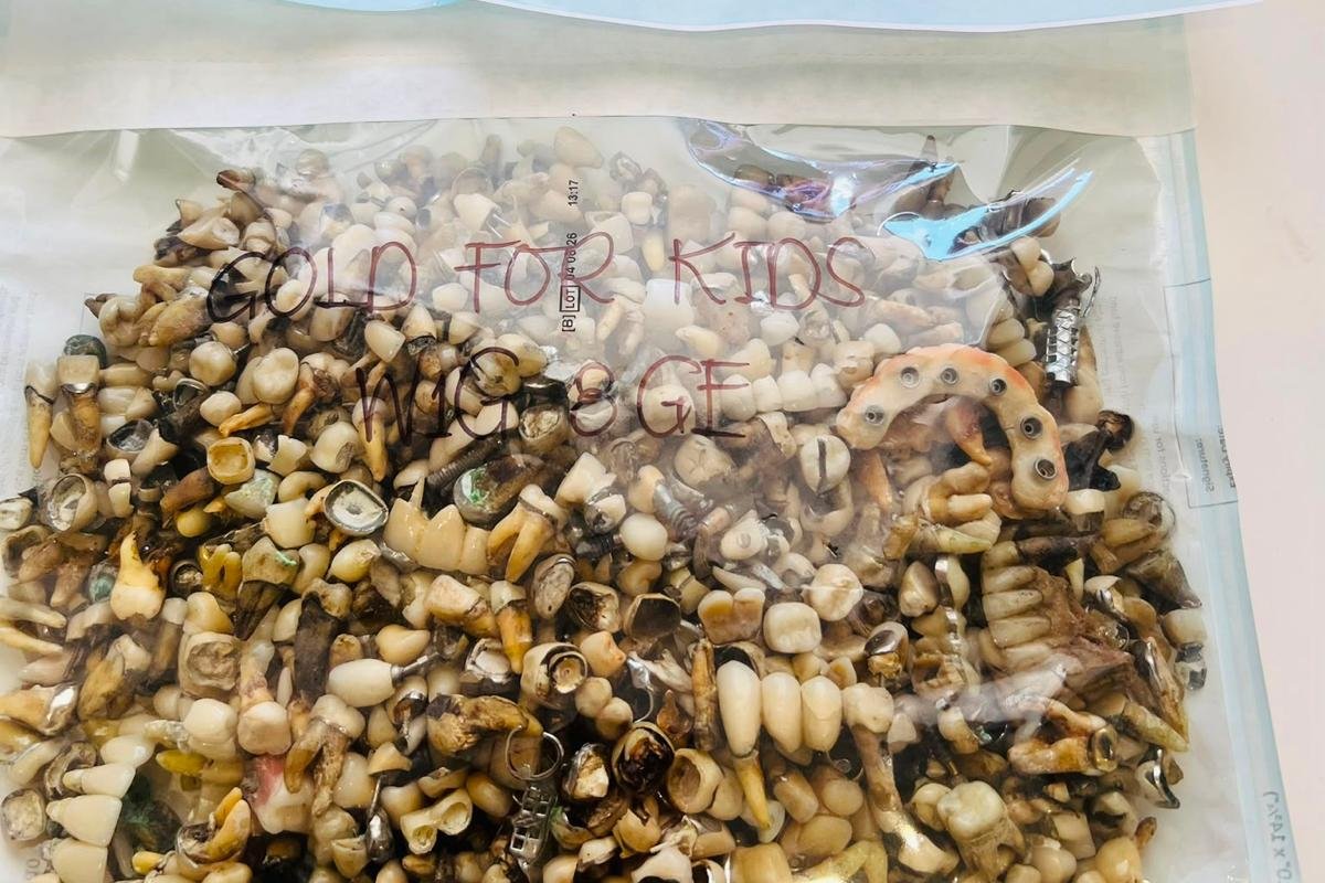 £17,000 from dental scrap: our July melt result