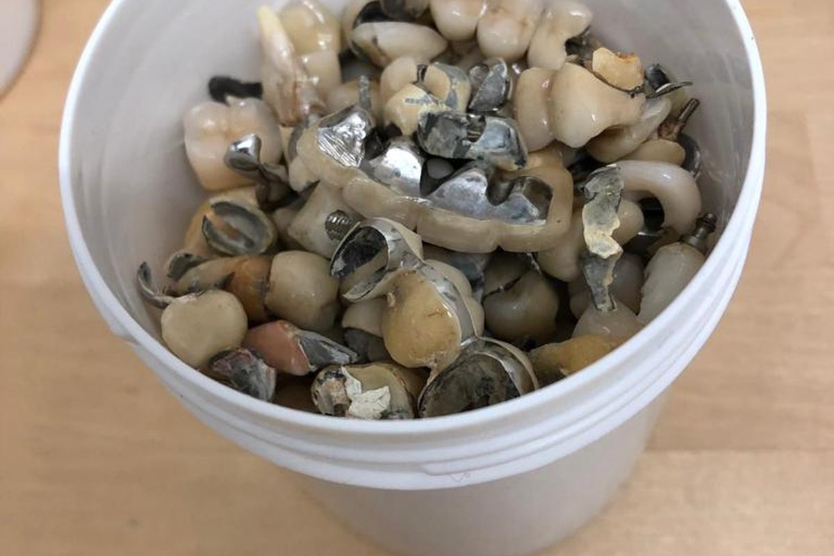 What to do with scrap dental gold: a guide for UK practices