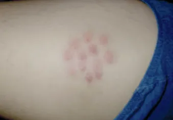 IV NUTRIENT THERAPY NANAIMO BC intravenous therapy, myers cocktail b12 injection  complex injection, energy, mood, immune balance, nanaimo injections, pain, healing