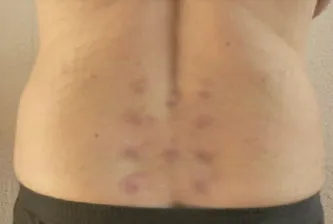 IV NUTRIENT THERAPY NANAIMO BC intravenous therapy, myers cocktail b12 injection  complex injection, energy, mood, immune balance, nanaimo injections, pain, healing