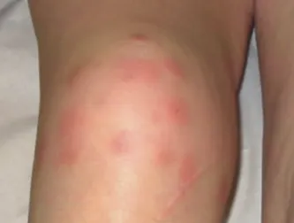 IV NUTRIENT THERAPY NANAIMO BC intravenous therapy, myers cocktail b12 injection  complex injection, energy, mood, immune balance, nanaimo injections, pain, healing