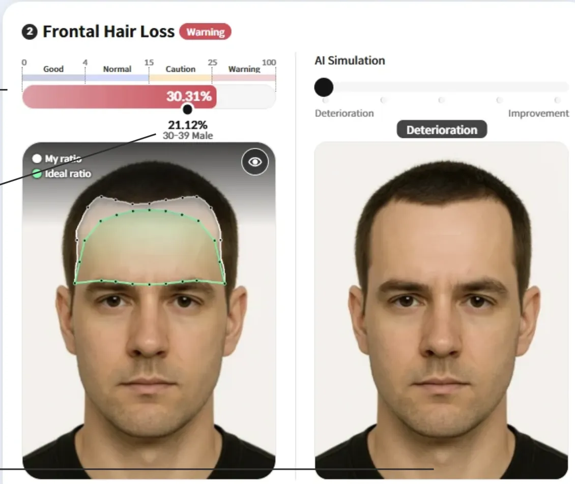 Advanced hair analysis