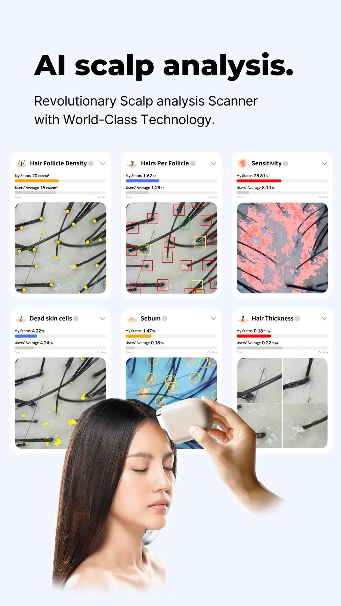 Advanced scalp analysis using AI technology
