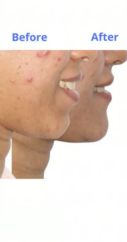 Patient smile transformation 6