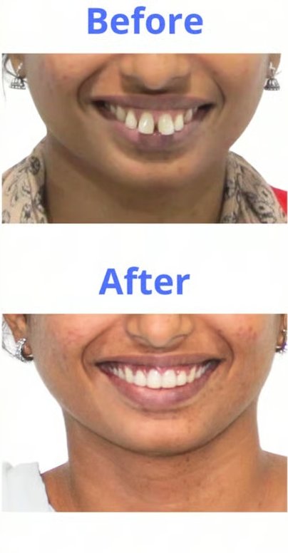 Patient smile transformation 5