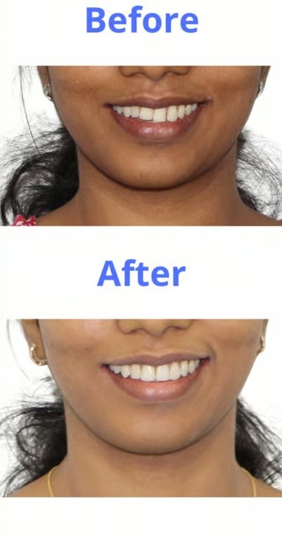 Patient smile transformation 2