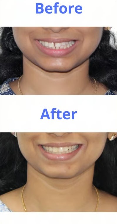 Patient smile transformation 7