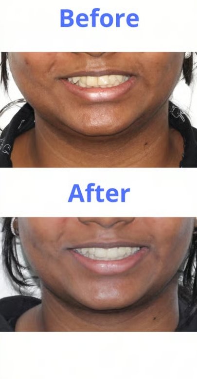 Patient smile transformation 8