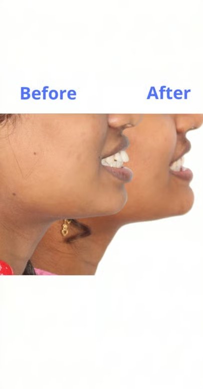 Patient smile transformation 9