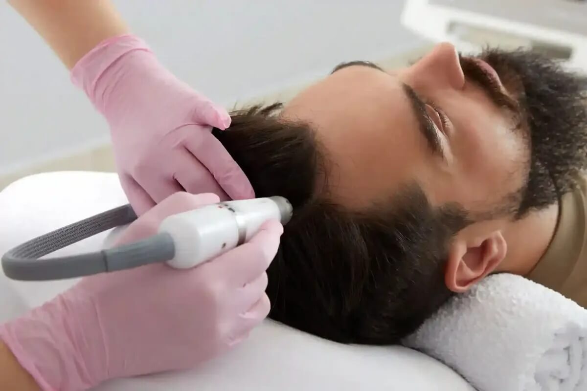 Hair Transplant Treatment