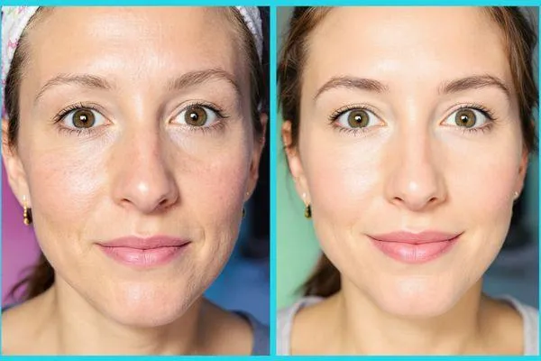 Unveil Your Radiance