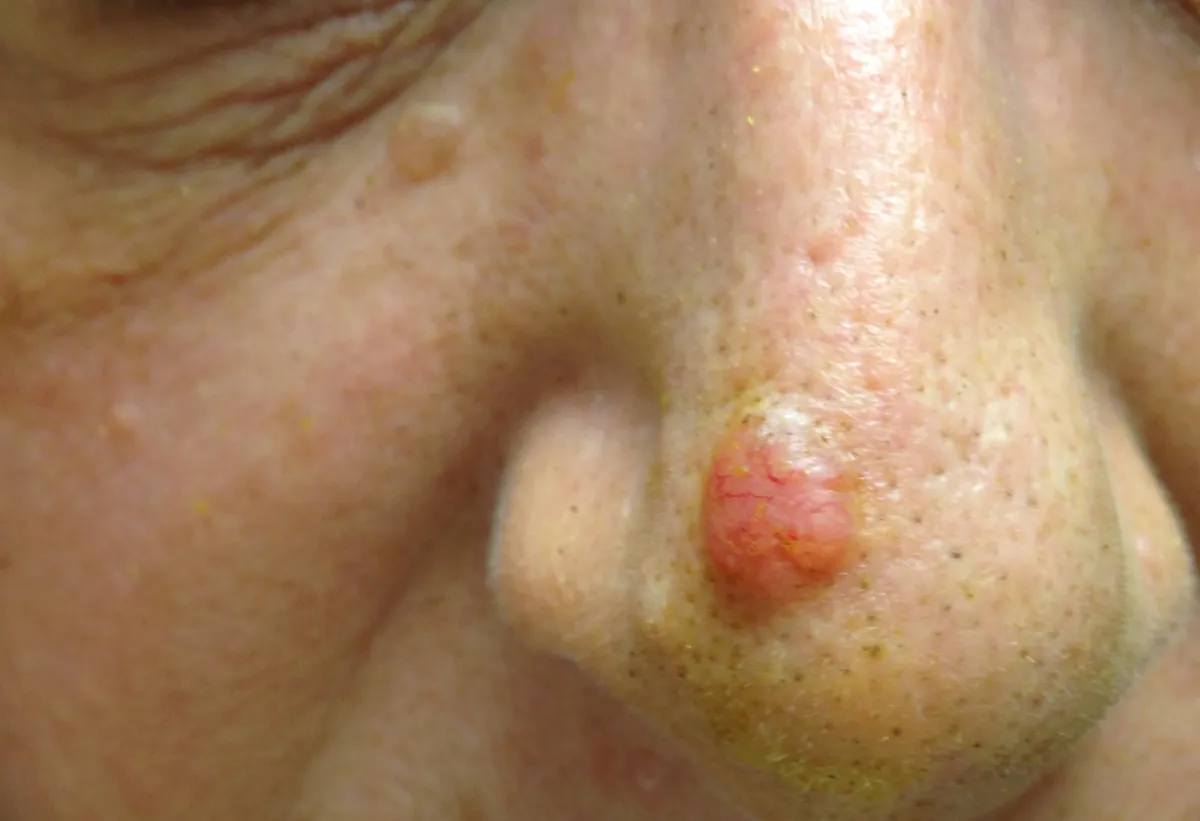 Cancer & Chronic Disease Treatment