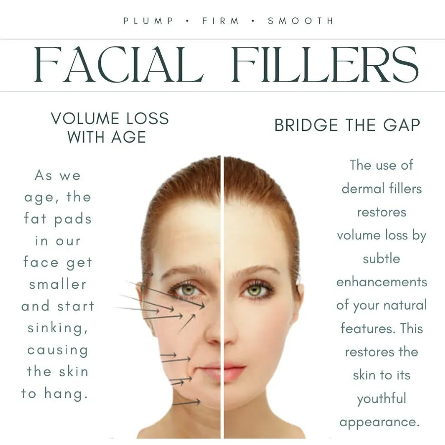 A graphic that shows before and after of dermal facial filler injections. The left side is aging while the right side of the photo has a restored youthful appearance.