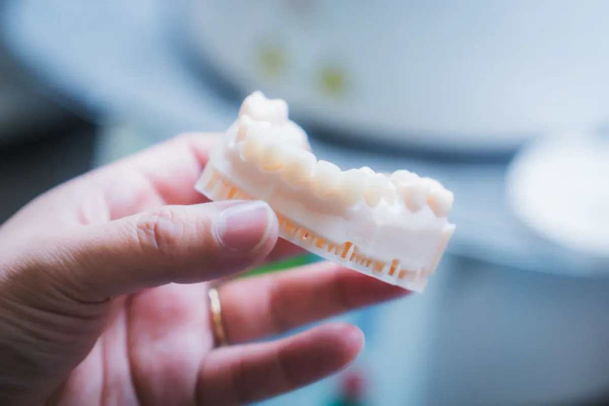 In-house 3D printed dental model used for smile design planning at Just Wright Dental and Implant Center, Corsicana, Texas