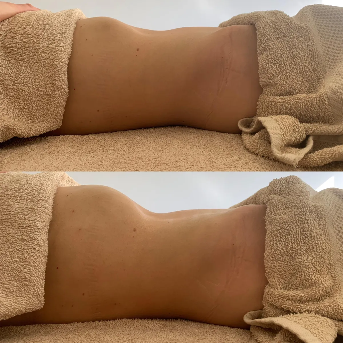 massage lymphatic drainage tweed heads gold coast