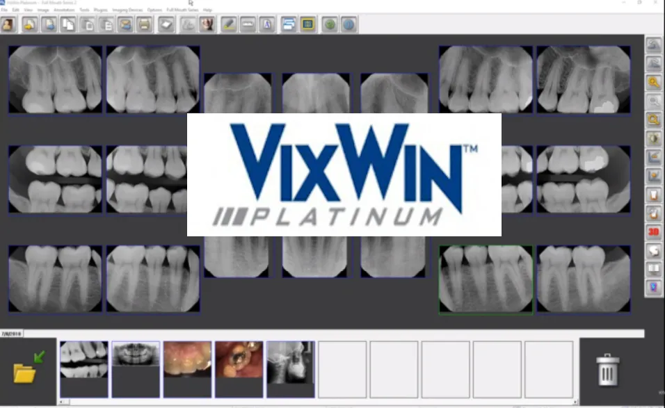 Vixwin Platinum Software