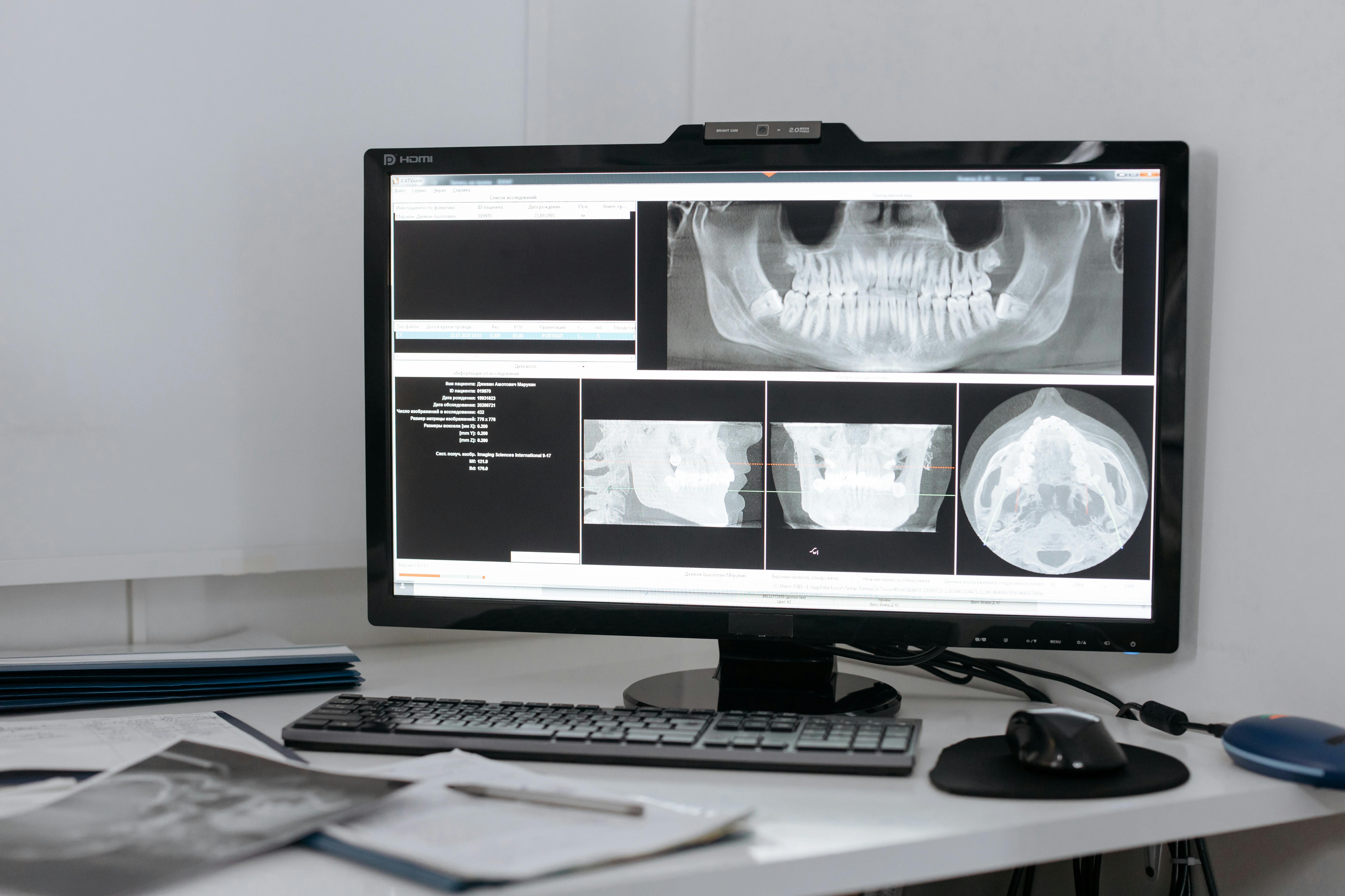 Why Dental PMS and Imaging Software Breaks After Updates