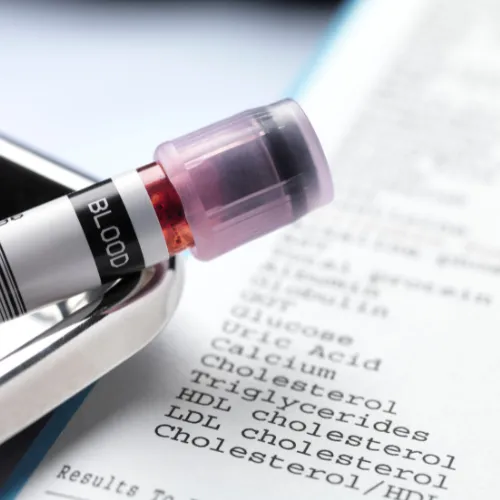 Close up of top of blood vial with blurred lab report in background