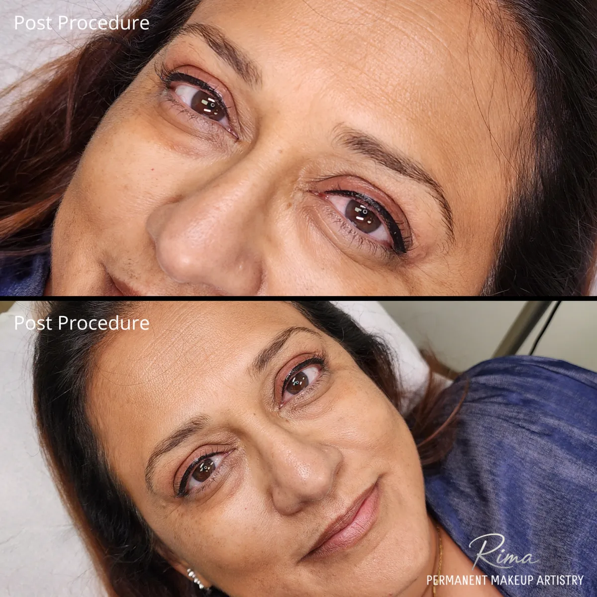 Post Procedure Permanent Eyeliner by Rima Kay, Oklahoma City