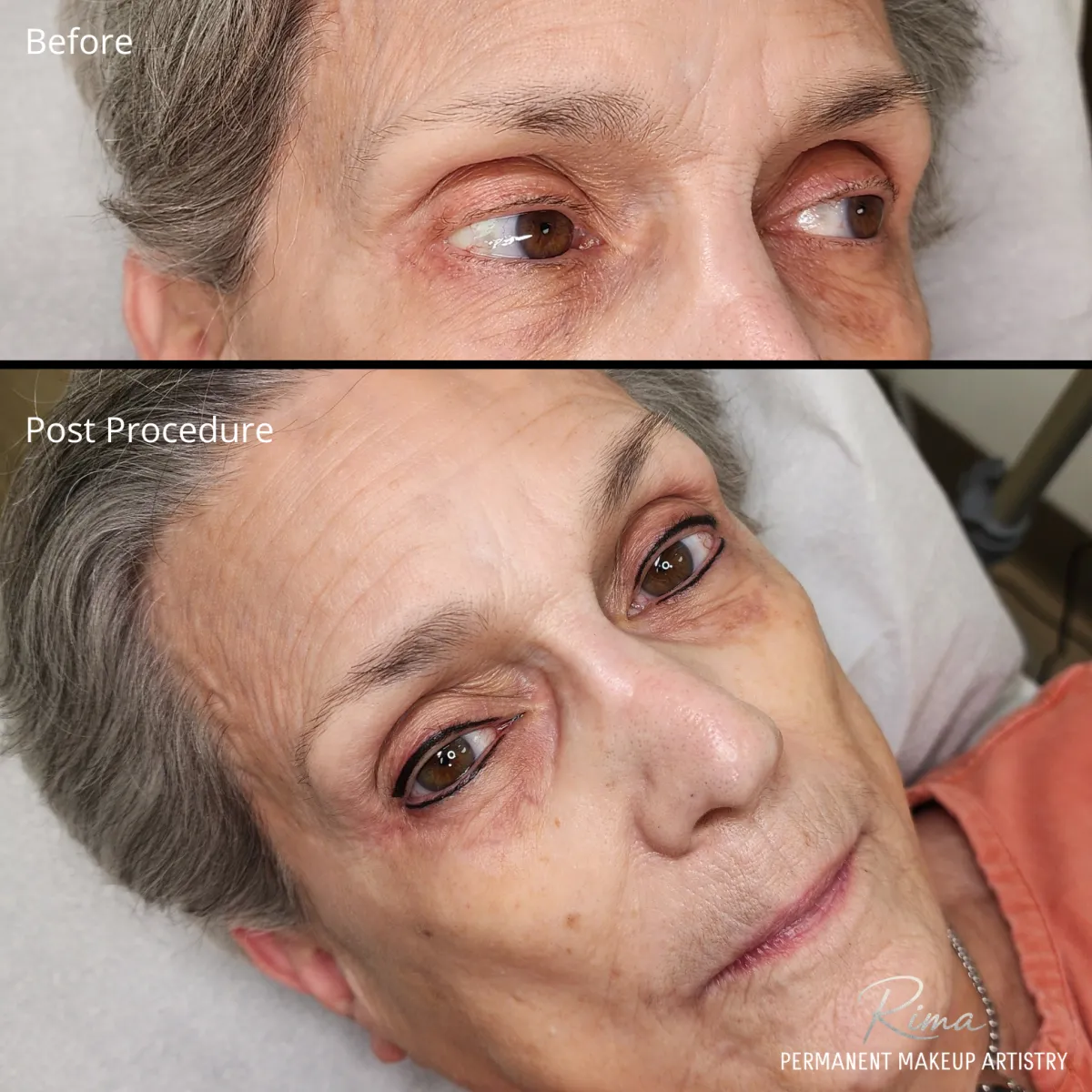 Post Procedure Permanent Eyeliner by Rima Kay, Oklahoma City