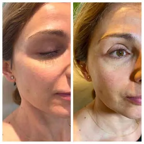 Full Face
