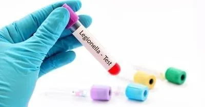 person filling white plastic cup with water