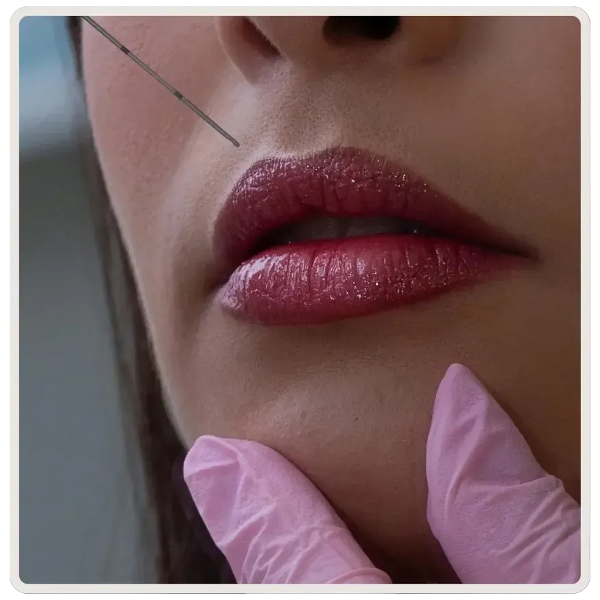Enhance lips, cheeks, and chin naturally with nurse-administered dermal fillers in Toronto. Soft, long-lasting facial contouring tailored to your features.