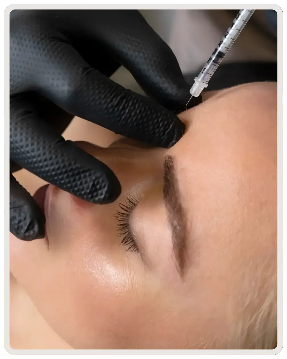 Anti-wrinkle treatments (Botox) Nurse administering Botox anti-wrinkle treatment at My Nurse Injector clinic in Toronto for natural facial rejuvenation