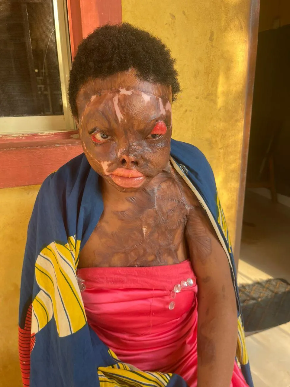 Hospital care and prayers