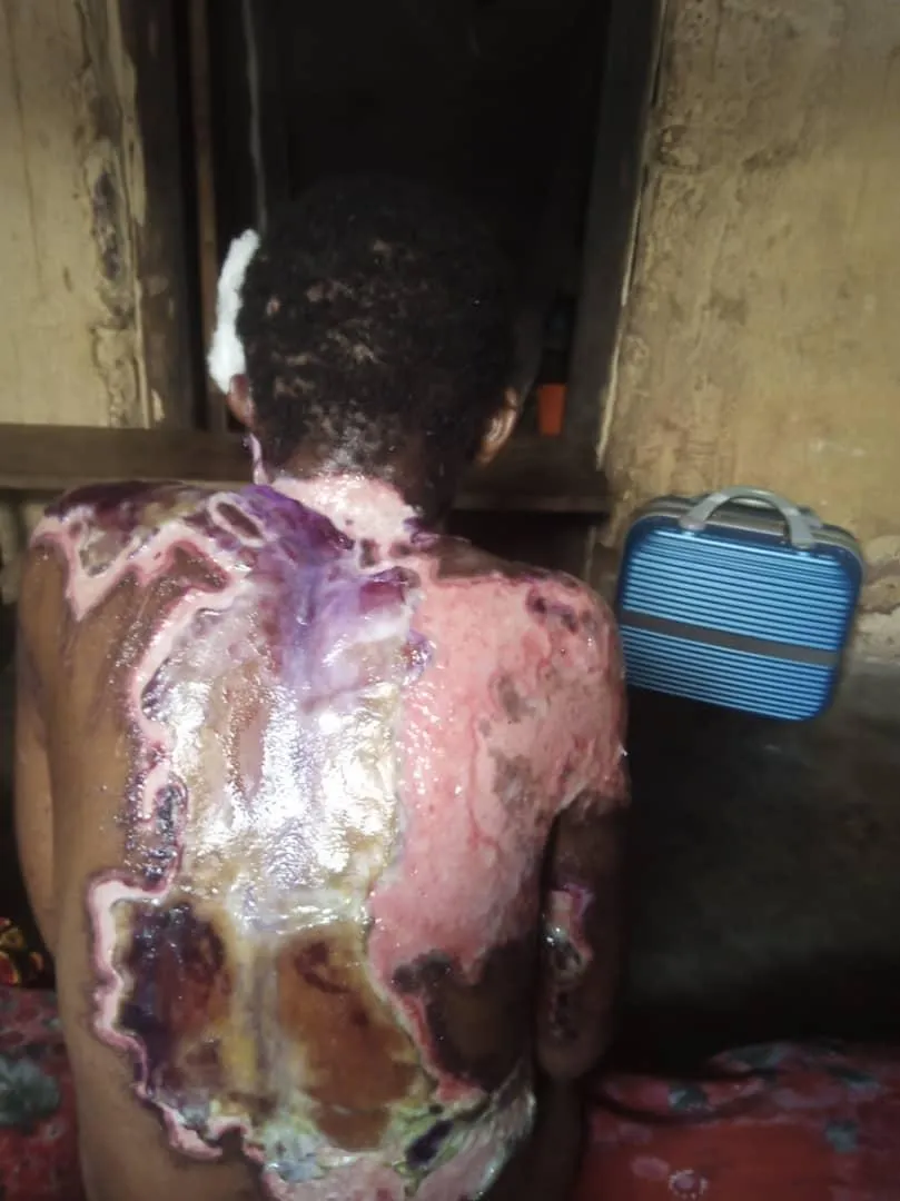 Disabled and motherless children support