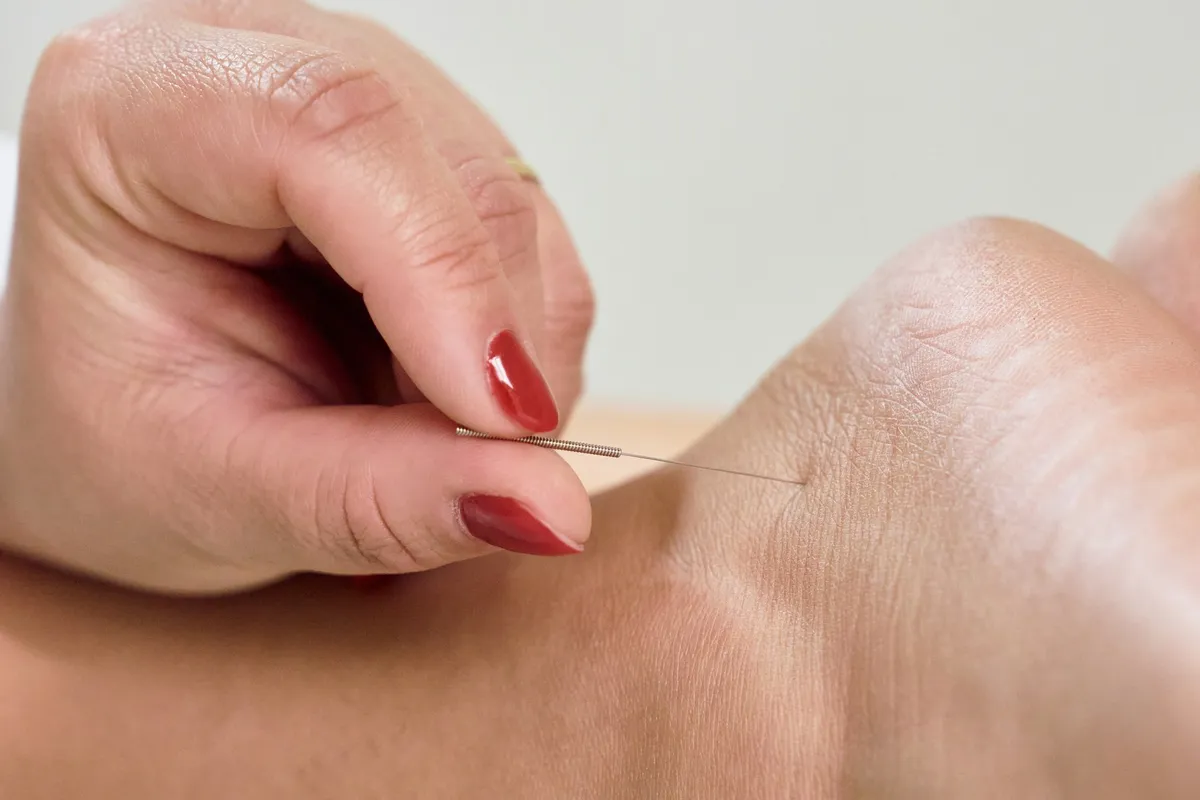 Signs You May Need Acupuncture Care in Vancouver