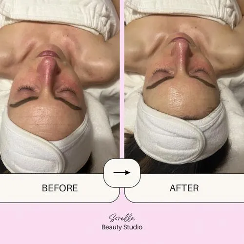 Korean Skincare in Bensalem, PA by Sorella Beauty Studio
