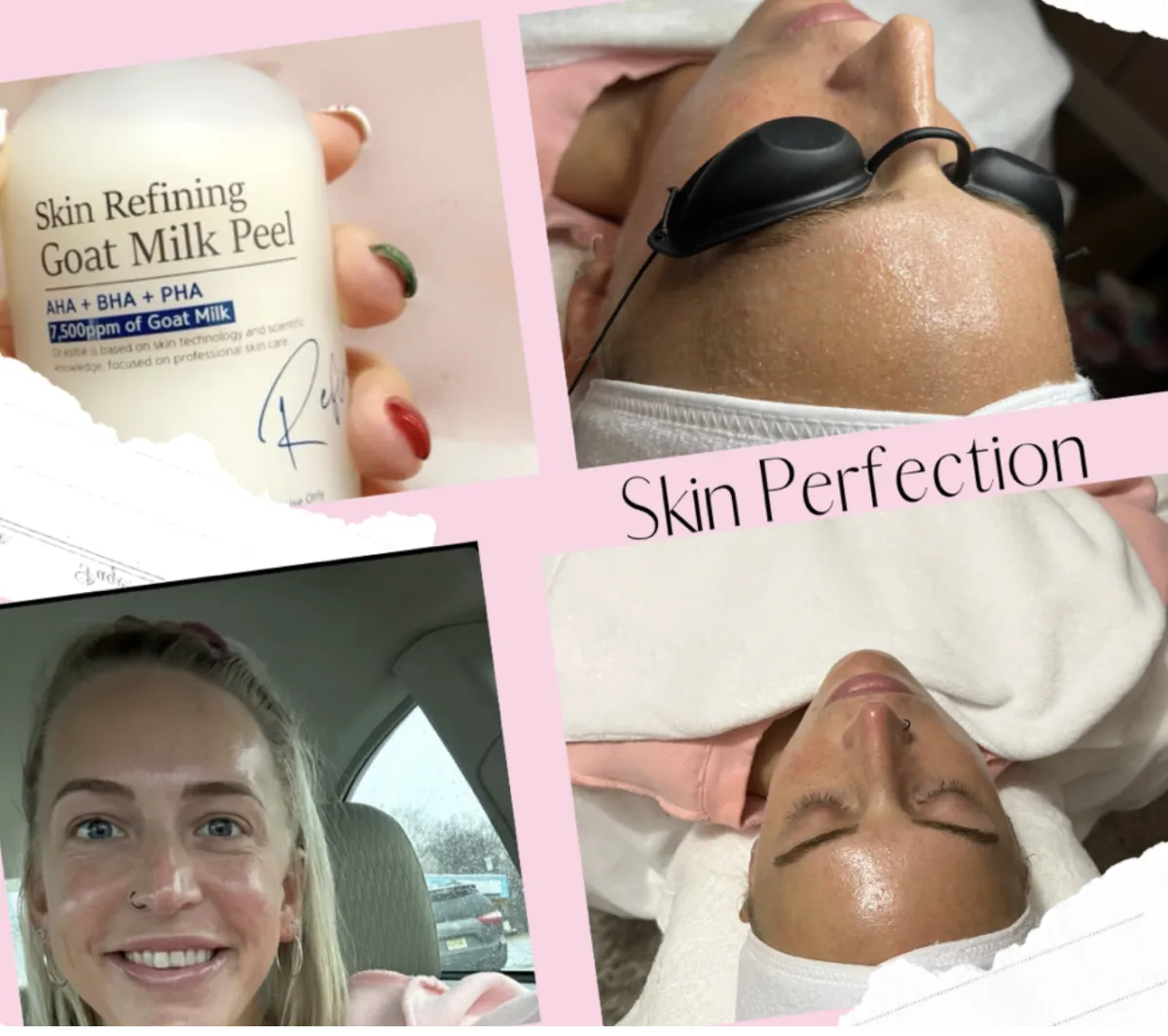 Goat Milk Peel (Add-On) in Bensalem, PA by Sorella Beauty Studio