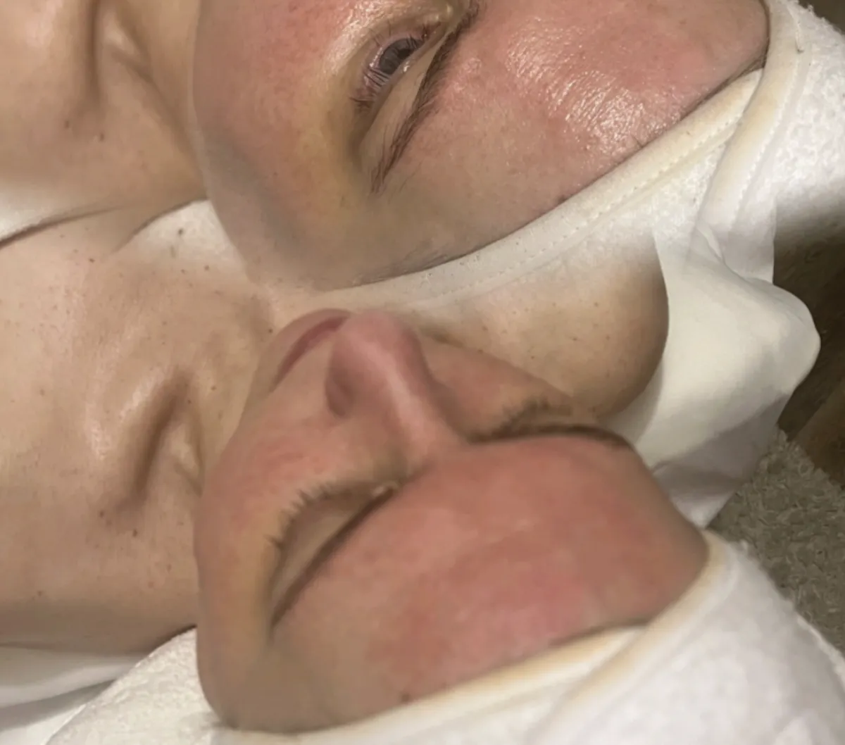 Time Rewind / Anti-Aging Facial in Bensalem, PA by Sorella Beauty Studio
