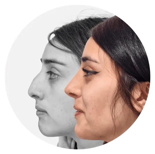 Circular graphic showing a double exposure or progression of a woman's profile, one in black and white and one in color