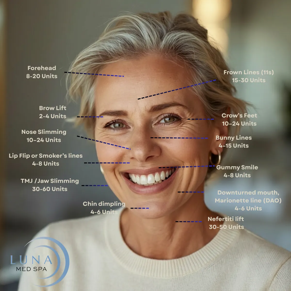 Units required for botox treatment